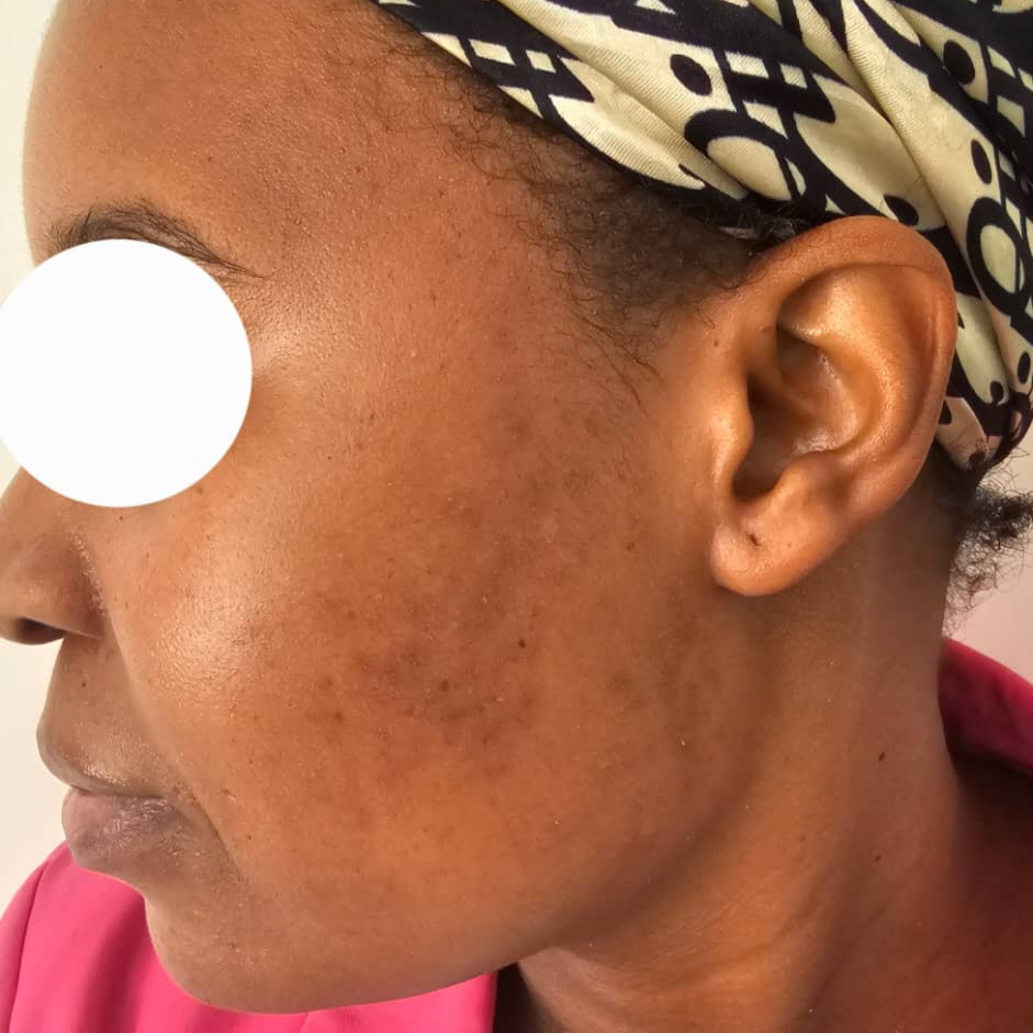 MediSkin Services